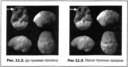 Дэниэл Амен - Великолепный мозг в любом возрасте