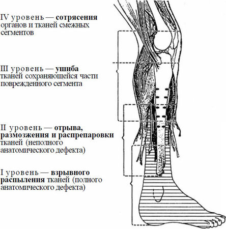 Александр Минченко - Раны. Лечение и профилактика осложнений. Учебное пособие