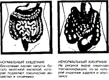Поль Брэгг, Патриция Брэгг - Соль здоровья - в кислой капусте без соли!