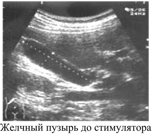 Тамара Якубчик - Клиническая гастроэнтерология
