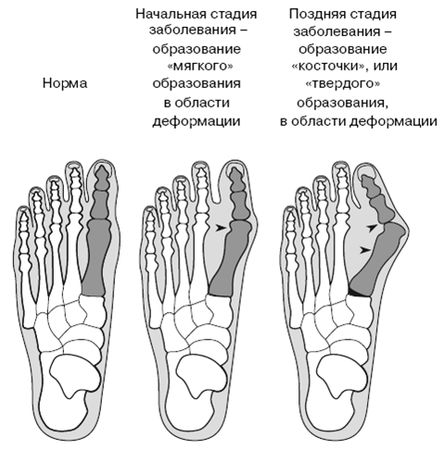 Гленн Коуплэнд, Стэнли Соломон - Все о здоровье ваших ног. От младенчества до...