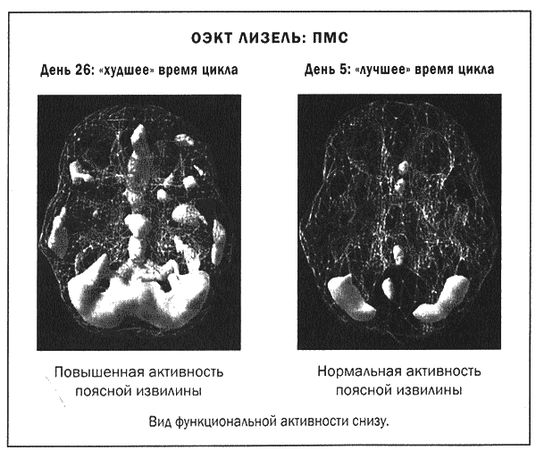 Дэниел Амен - Мозг и душа
