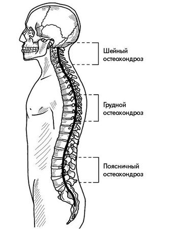 Валентин Григорьев - Жизнь без боли в спине. Лечение сколиоза, остеопороза,...